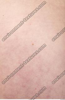 photo texture of white skin 0010